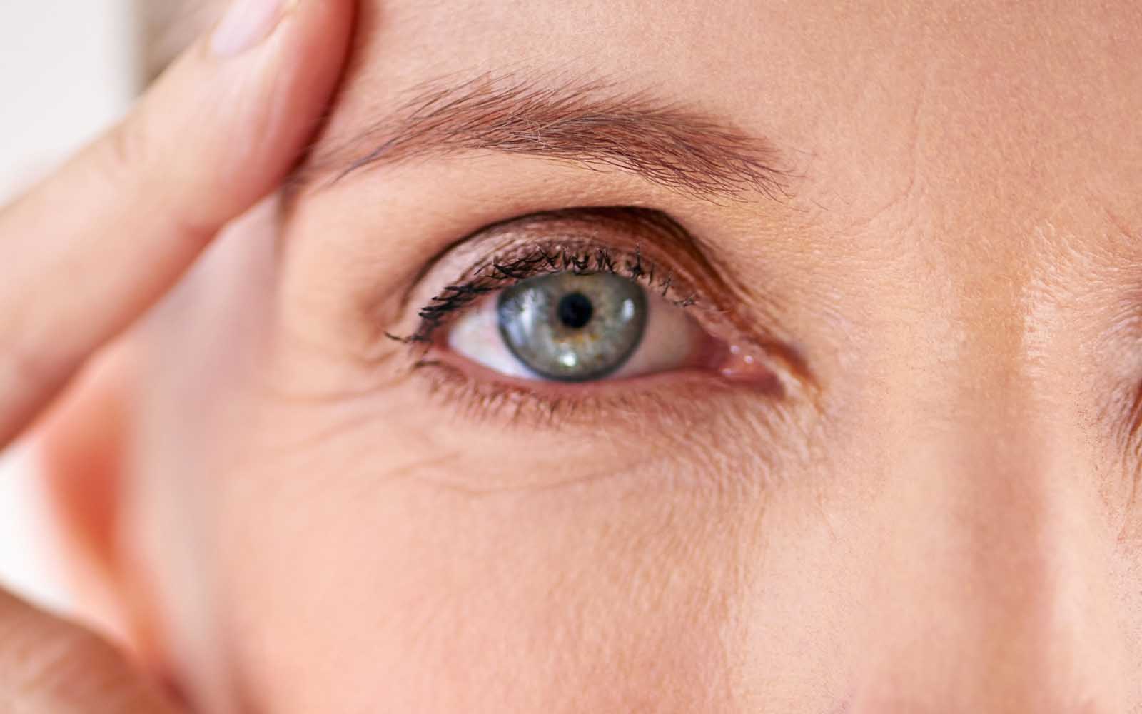 Eyelid Reconstruction treatment in Belgravia with Jonathan Dunne