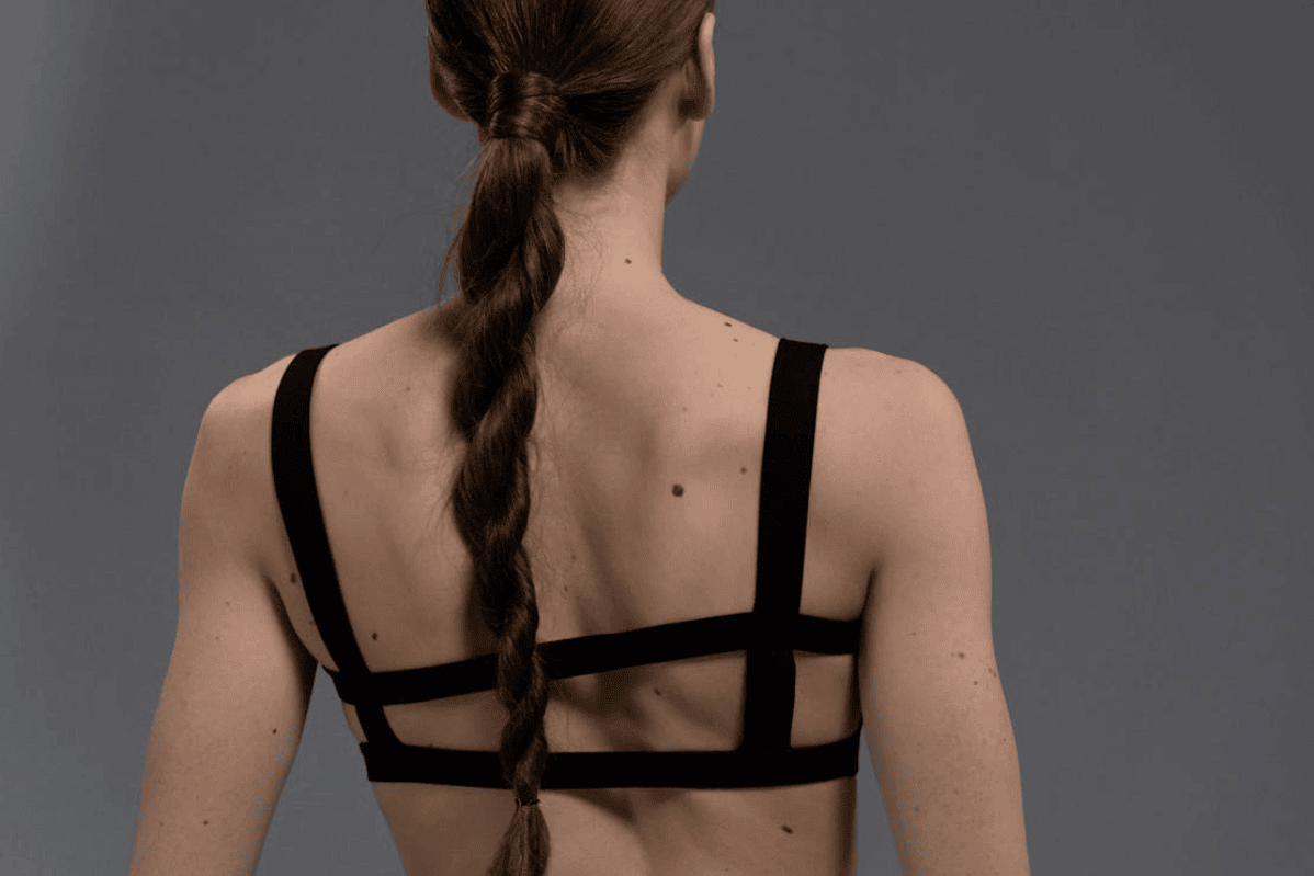woman with moles on her back