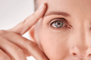 womans eye after upper blepharoplasty with Jonathan Dunne