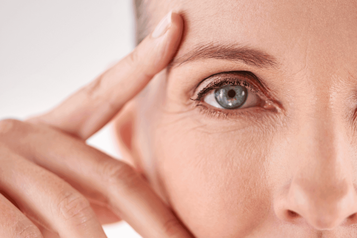 womans eye after upper blepharoplasty with Jonathan Dunne